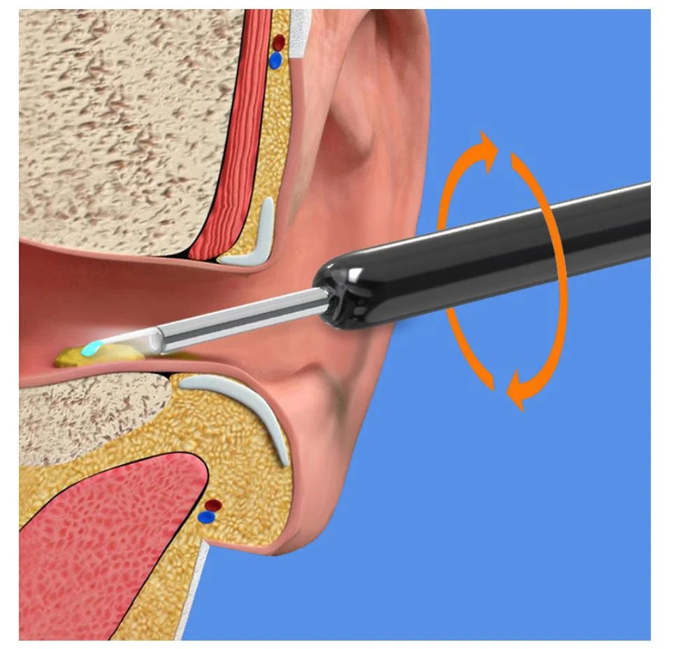 Smart Earwax Removal Kit with Camera
