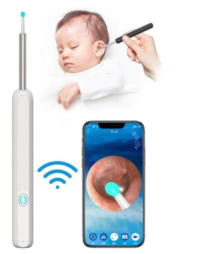 Smart Earwax Removal Kit with Camera