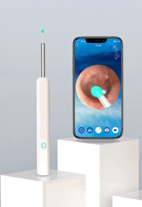 Smart Earwax Removal Kit with Camera