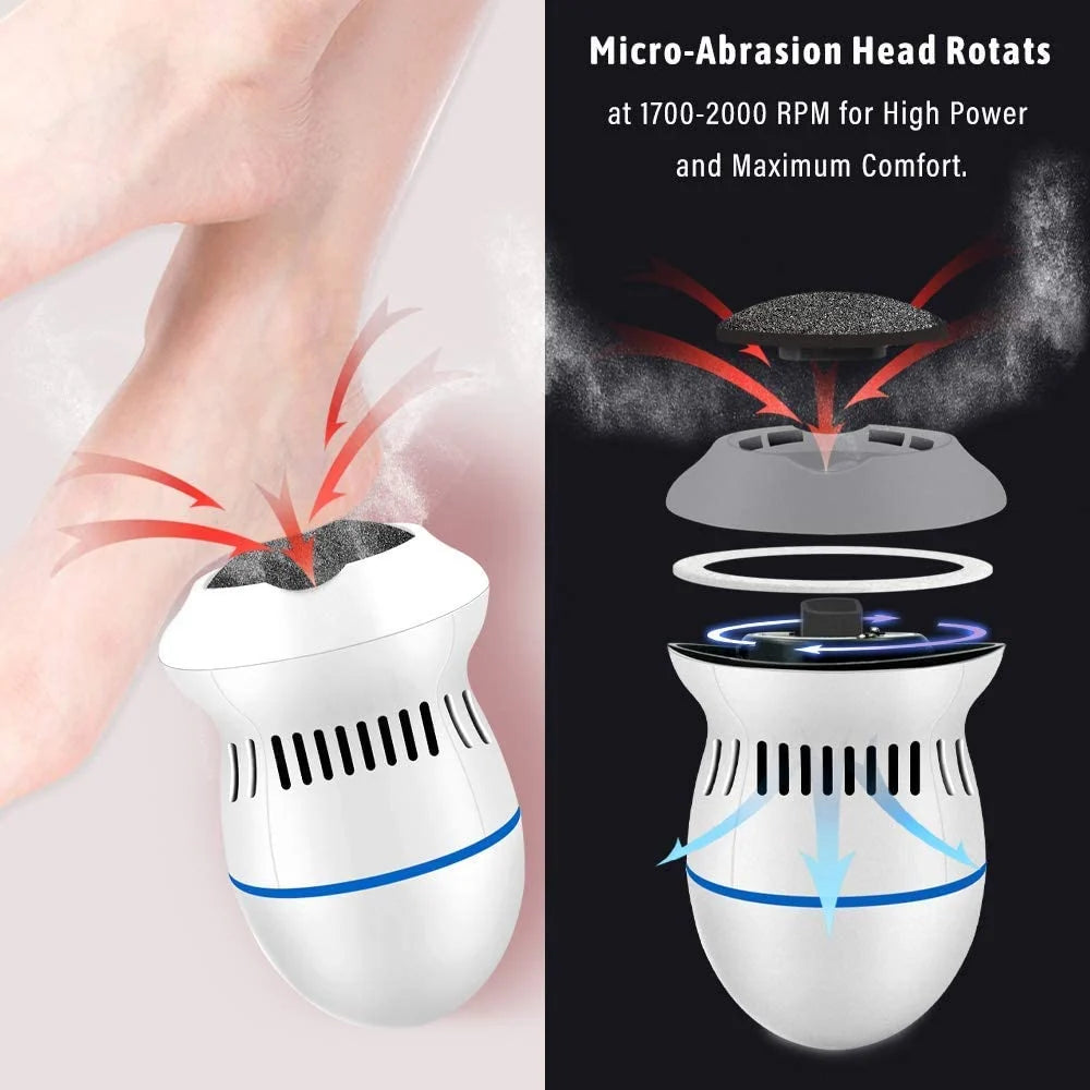 Dual-Speed Rechargeable Electric Callus Remover